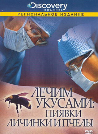 Discovery: Лечим укусами. Пиявки, личинки и пчелы (2000)